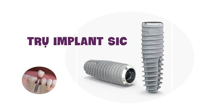 Dòng trụ Implant SIC có độ bền cao và thời gian sử dụng lâu