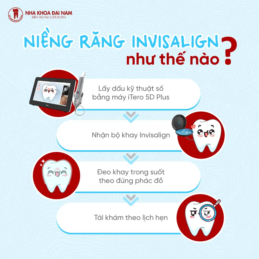 Diễn biến quá trình niềng răng trong suốt Invisalign