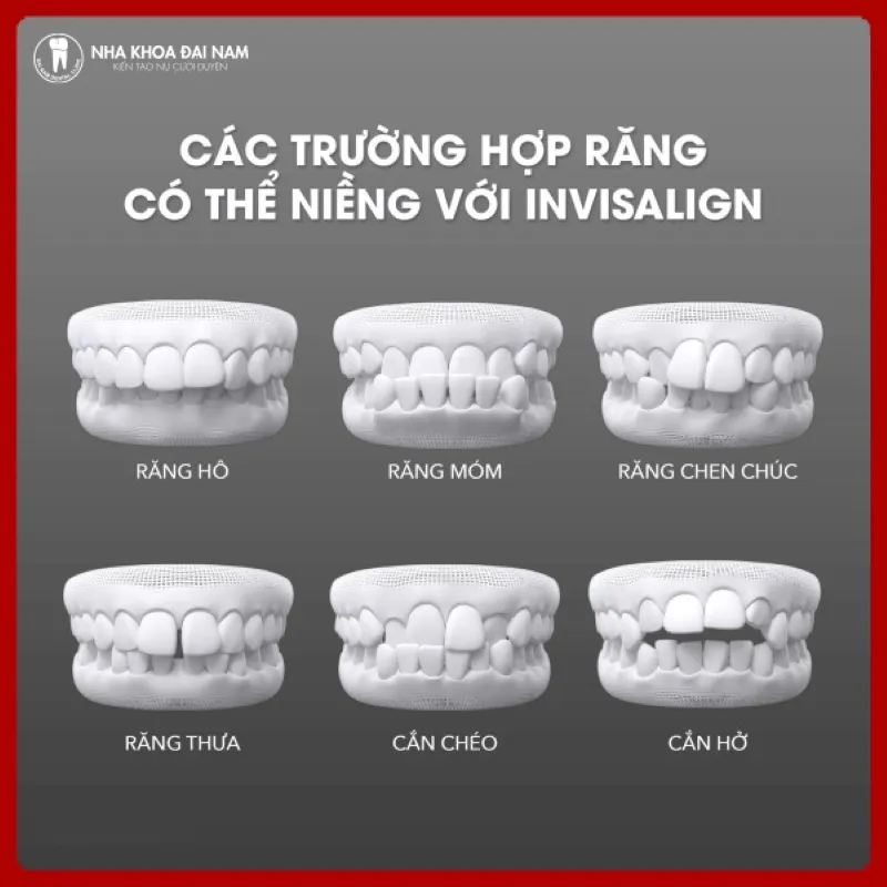 Niềng Invisalign phù hợp với hầu hết tình trạng răng